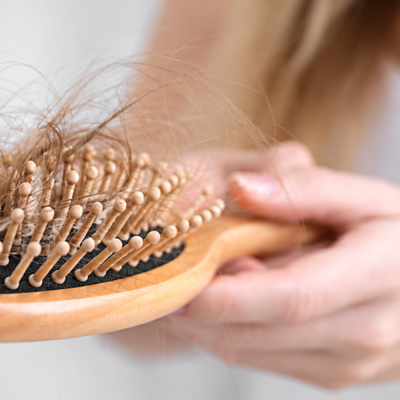 Mujer mostrando cabello acumulado en un cepillo durante la caída del cabello en otoño